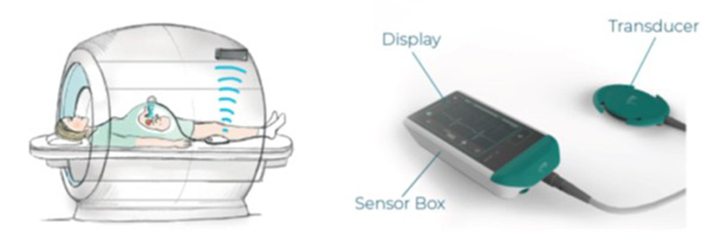 Schematische Darstellung der Funktionsweise des von northh medical enntwickelten Geräts "smart sync"